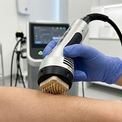 RF-лифтинг тела: подтяжка кожи живота и бёдер в Perfect Clinic Санкт-Петербург